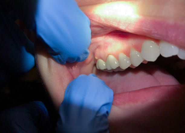 Best Tooth Pain Emergency Relief  in Pontiac, IL