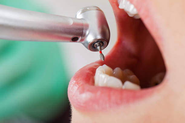 Best Broken Tooth Emergency  in Pontiac, IL